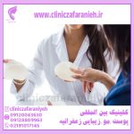بهترین جراح پروتز سینه در تهران